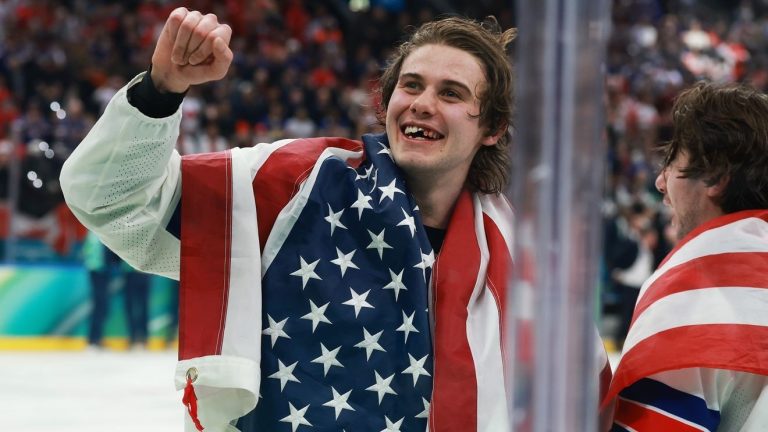 Olympic hero Jack Hughes has new chiclets as NHL dentists get a moment in the spotlight